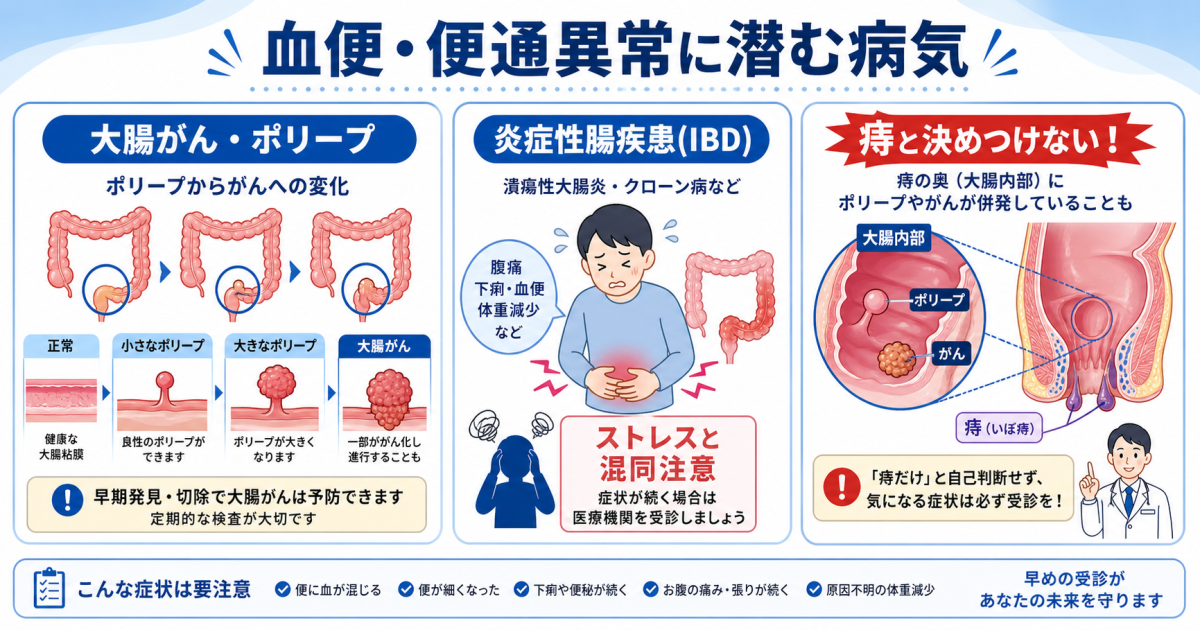 血便や便通異常から疑われる代表的な疾患と「痔」で済ませてはいけない理由