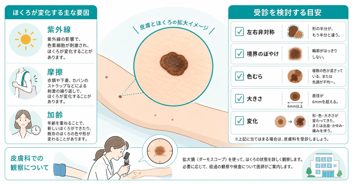 ほくろが大きくなるのは病気？皮膚科を受診すべき目安と検査の流れ